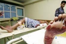 Attack on Colombo air force base 